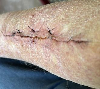 Click image for larger version  Name:	IMG_3221.jpg Views:	0 Size:	553.9 KB ID:	106653